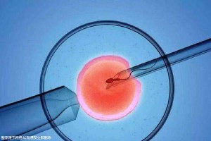 人工高龄供卵代怀微信群